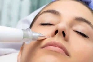 Best Actinic Keratoses Removal 3 Actinic keratoses Devizes solutions - book in today!