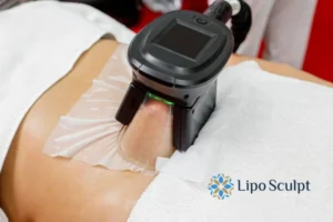 Does Fat Freezing At Home Work? 3 Fat freezing at home from Lipo Sculpt Devizes